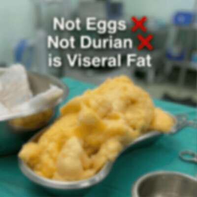 Zenso Visceral Fat